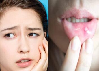 പതിവായി-വായ്പ്പുണ്ണ്-വരാറുണ്ടോ?-നിസാരമാക്കരുത്;-ക്രോണ്‍സ്-ആന്‍ഡ്-സീലിയാക്-രോ​ഗലക്ഷണമാകാം