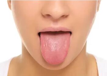 നാവ്-നന്നായാൽ-എല്ലാം-നന്നാവും;-നാവ്-പരിശോധിച്ച്-98-ശതമാനം-രോഗങ്ങളും-കൃത്യമായി-കണ്ടെത്തി-എഐ-മോഡല്‍