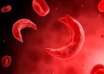 ‘ശ്രദ്ധിക്കേണ്ട-കാര്യങ്ങള്‍,-ചികിത്സാ-കേന്ദ്രം,-സഹായ-പദ്ധതികള്‍’;-ഒരു-വർഷം-ക്യാമ്പയിന്‍-‘അറിയാം-അകറ്റാം-അരിവാള്‍കോശ-രോഗം’