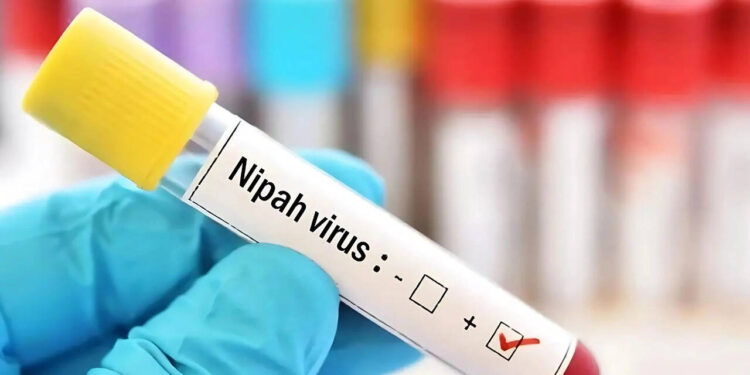 നിപ-പകരുന്നതെങ്ങനെ,-വൈറസ്-ബാധയുടെ-ലക്ഷണങ്ങള്-എന്തെല്ലാം-?-;-രോഗത്തെ-പ്രതിരോധിക്കാന്-അറിയേണ്ട-7-കാര്യങ്ങള്