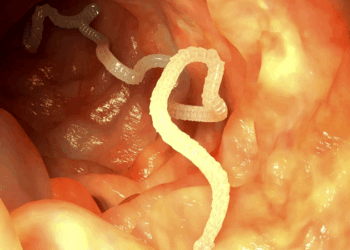 കാര്യമാക്കിയില്ലെങ്കിൽ-കൈവിട്ടുപോകും!-തലച്ചോർ-നിയന്ത്രിക്കുന്ന-ടേപ്പ്-വേം-അണുബാധകൾ,-പേടിക്കണം-ഈ-കാലത്തെ.