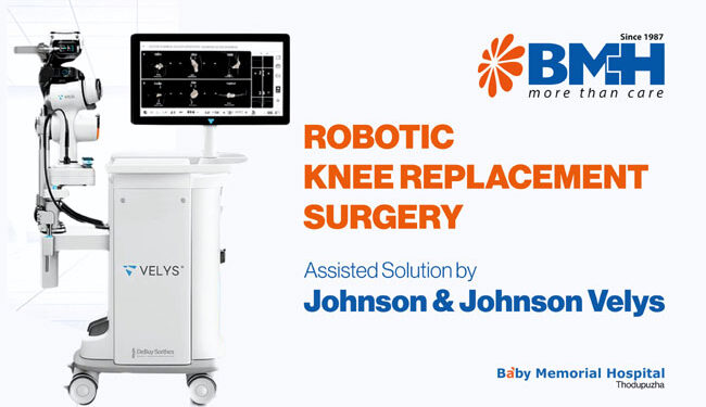തൊടുപുഴ-ബേബി-മെമ്മോറിയൽ-ഹോസ്പിറ്റലിൽ-മുട്ടുമാറ്റിവയ്ക്കലിന്-റോബോട്ടിക്-സംവിധാനം;-കേരളത്തിൽ-ഇതാദ്യം;-നേതൃത്വം-വഹിക്കുക-ഓർത്തോപീഡിക്സ്-മേധാവി-ഡോ-ഒടി.-ജോർജ്