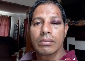 ഇന്ത്യൻ-വംശജരുടെ-ഭീതിയൊഴിയുന്നില്ല;-ആറ്-വയസുകാരിക്ക്-പിന്നാലെ-51കാരനും-അയർലണ്ടിൽ-ക്രൂര-മർദ്ദനം