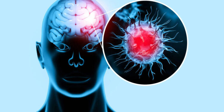 അമീബിക്-മസ്തിഷ്‌കജ്വരത്തിനെതിരെ-വേണം-അതീവ-ജാഗ്രത-;-രോഗലക്ഷണങ്ങള്‍,-ചികിത്സ…അറിയേണ്ടതെല്ലാം