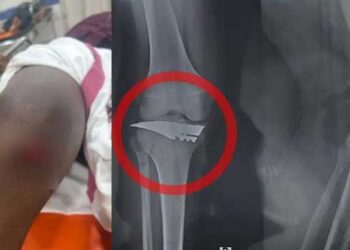 വിദ്യാർത്ഥിനിയെ-ശല്യം-ചെയ്തത്-ചോദ്യം-ചെയ്ത-എസ്എഫ്ഐ-പ്രവർത്തകന്-കുത്തേറ്റു,-ആയുധത്തിൻറെ-ഒരു-ഭാഗം-കാലിൽ-തറച്ചുകയറിയ-വൈഷ്ണവിനെ-ശസ്ത്രക്രിയയ്ക്ക്-വിധേയനാക്കി,-പിന്നിൽ-സംഘമെന്ന്-സൂചന