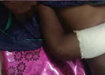 സൈക്കിളിൽ-നിന്നു-വീണു-പരുക്കേറ്റ-കുട്ടിയുടെ-കൈ-പ്ലാസ്റ്ററിട്ടുവിട്ടു,-പിന്നാലെ-മുറിവ്-പഴുത്ത്-വ്രണമായി!!-ഏഴുവയസുകാരന്റെ-കൈ-മുറിച്ചുമാറ്റേണ്ട-അവസ്ഥയെന്ന്-പിതാവ്,-പത്തനംതിട്ട-ജനറൽ-ആശുപത്രിക്കെതിരെ-​ഗുരുതര-ചികിത്സാ-പിഴവ്-ആരോപണം