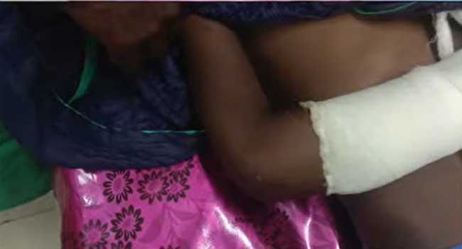 സൈക്കിളിൽ-നിന്നു-വീണു-പരുക്കേറ്റ-കുട്ടിയുടെ-കൈ-പ്ലാസ്റ്ററിട്ടുവിട്ടു,-പിന്നാലെ-മുറിവ്-പഴുത്ത്-വ്രണമായി!!-ഏഴുവയസുകാരന്റെ-കൈ-മുറിച്ചുമാറ്റേണ്ട-അവസ്ഥയെന്ന്-പിതാവ്,-പത്തനംതിട്ട-ജനറൽ-ആശുപത്രിക്കെതിരെ-ഗുരുതര-ചികിത്സാ-പിഴവ്-ആരോപണം