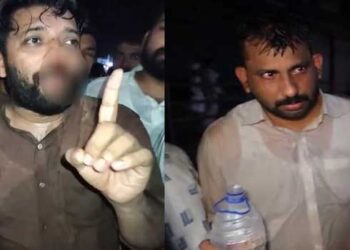 എൽഡിഎഫ്-യുഡിഎഫ്-റാലിക്കിടെ-മർ​ദനം,-ഷാഫി-പറമ്പിൽ-എംപിയുടെ-മുഖത്ത്-പരുക്ക്,-പോലീസ്-നടത്തിയ-കണ്ണീർ-വാതക-പ്രയോഗത്തിനിടെ-ശ്വാസതടസം,-ലാത്തിചാർജിൽ-ഡിസിസി-പ്രസിഡന്റ്-ഉൾപ്പെടെയുള്ള-യുഡിഎഫ്-നേതാക്കൾക്കും-പരുക്ക്