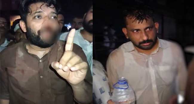 എൽഡിഎഫ്-യുഡിഎഫ്-റാലിക്കിടെ-മർദനം,-ഷാഫി-പറമ്പിൽ-എംപിയുടെ-മുഖത്ത്-പരുക്ക്,-പോലീസ്-നടത്തിയ-കണ്ണീർ-വാതക-പ്രയോഗത്തിനിടെ-ശ്വാസതടസം,-ലാത്തിചാർജിൽ-ഡിസിസി-പ്രസിഡന്റ്-ഉൾപ്പെടെയുള്ള-യുഡിഎഫ്-നേതാക്കൾക്കും-പരുക്ക്