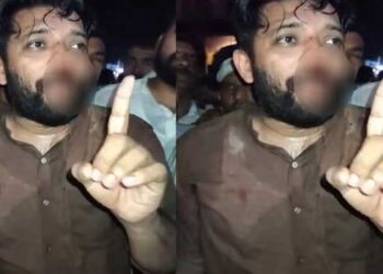 ഷാഫിക്കിട്ട്-പണിതത്-തെരഞ്ഞെടുപ്പിൽ-തിരിച്ചടിക്കുമോയെന്ന-പേടിയിൽ-സിപിഎം,-രാഷ്ട്രീയ-വിശദീകരണ-യോ​ഗം-ചൊവ്വാഴ്ച!!-ഷാഫിയെ-തല്ലിയ-സംഭത്തിൽ-സുനിൽകുമാർ,-ഹരിപ്രസാദ്,-സിവിൽ-പോലീസ്-ഓഫീസർ-എന്നിവർക്കു-മറുപണി-കൊടുക്കാൻ-കോൺ​ഗ്രസ്,-ഡിജിപിക്ക്-പരാതി,-നടപടിയായില്ലെങ്കിൽ-റൂറൽ-എസ്പിയുടെ-ഔദ്യോഗിക-വസതിയടക്കം-ഉപരോധിക്കും