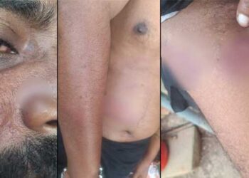 കാപ്പാ-കേസിലടക്കം-പ്രതിയായ-പിഎസ്-ശരത്തെന്നു-കരുതി-പോലീസ്-കസ്റ്റഡിയിലെടുത്തത്-നിരപരാധിയായ-മറ്റൊരു-ശരത്തിനെ!!-രാത്രി-വീട്ടിൽ-കയറിവന്ന-പോലീസ്-യുവാവിനെ-തലങ്ങും-വിലങ്ങും-മർദിച്ചു,-ലാത്തികൊണ്ട്-വയറ്റിലും-പുറത്തും-അടിയും-കുത്തും,-ഉന്തിത്തള്ളി-ജീപ്പിൽ-കയറ്റുന്നതിനിടെ-തലയിടിച്ച്-പരുക്ക്