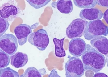 അക്യൂട്ട്-മൈലോയ്ഡ്-ലുക്കീമിയ!-അവഗണിക്കരുത്-ഈ-ലക്ഷണങ്ങൾ;-പ്രായഭേദമന്യേ-രോഗബാധയെന്ന്-മുന്നറിയിപ്പ്