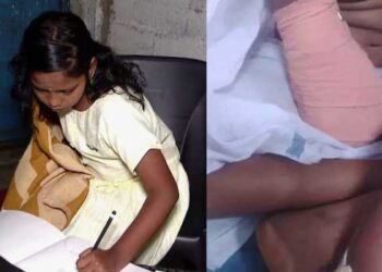 അവൾ-എഴുതി-പഠിക്കുവാണ്-ഇടതു-കൈകൊണ്ട്,-ഡോക്ടറുടെ-അനാസ്ഥയിൽ-വലതു-കൈ-നഷ്ടപ്പെട്ട-കുഞ്ഞു-വിനോദിനിക്ക്-പുതുവർഷത്തിലും-സ്കൂളിൽ-പോകാനായിട്ടില്ല,-മുറുച്ചുമാറ്റിയ-വലതു-കൈയ്ക്ക്-പകരം-കൃത്രിമ-കൈ-വയ്ക്കാൻ-സർക്കാർ-പ്രഖ്യാപിച്ച-2-ലക്ഷം-അപര്യാപ്തം,-മറ്റു-സാമ്പത്തികമില്ല…-കലക്ടറെ-കണ്ട്-പരാതി-അറിയിച്ചിട്ടുണ്ടെന്ന്-കുടുംബം