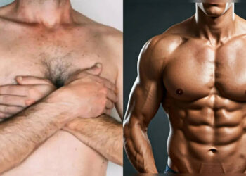 ജിമ്മിൽ-കഠിനമായി-വ്യായാമം-ചെയ്താലും-മാറാത്ത-പുരുഷന്മാരുടെ-നെഞ്ച്-പ്രശ്നങ്ങൾ:-എന്താണ്-ജൈനകോമായാസ്റ്റിയ?