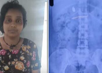 യുവതിക്ക്-എനിമ-വച്ച്-തൊണ്ടിമുതലിനായുള്ള-വനിതാ-പോലീസിന്റെ-കാത്തിരിപ്പ്-മൂന്നാം-ദിവസത്തിലേക്ക്…-ക്ലിനിക്കിലെത്തിയ-കുട്ടിയു‌ടെ-3.5-​ഗ്രാം-വരുന്ന-സ്വർണമാല-അടിച്ചുമാറ്റി-വിഴുങ്ങി,-എടുത്തിട്ടില്ലെന്ന്-യുവതി,-എക്സറേയിൽ-സ്വർണം-വയറ്റിലുണ്ടെന്ന്-കണ്ടെത്തൽ…’തൊണ്ടിമുതലും-ദൃക്സാക്ഷിയു’മായി-കേരളാ-പോലീസും-സമീനയും