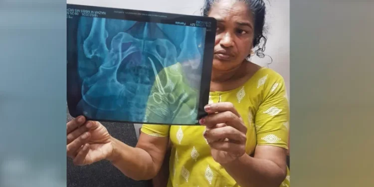 ആലപ്പുഴ-മെഡിക്കൽ-കോളേജിൽ-ഗുരുതര-വീഴ്ച!-വീട്ടമ്മയുടെ-വയറ്റിൽ-അഞ്ച്-വർഷമായി-കത്രിക