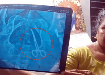 ശസ്ത്രക്രിയയ്ക്ക്-വിധേയയായ-വീട്ടമ്മയുടെ-വയറ്റിൽ-കത്രിക;-ദുരിത-വേദന-പേറാൻ-തുടങ്ങിയിട്ട്-അഞ്ച്-വർഷം;-വണ്ടാനം-മെഡിക്കൽ-കോളേജിനെതിരെ-ഗുരുതര-ആരോപണം