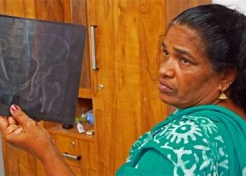 രണ്ട്-സർക്കാർ-ഡോക്ടർമാരുടെ-സാന്നിധ്യത്തിൽ-ഉഷയുടെ-ശസ്ത്രക്രിയ-പൂർത്തിയായി,-കത്രിക-പുറത്തെടുത്തു,-തൊണ്ടുമുതൽ-അമ്പലപ്പുഴ-ഡിവൈഎസ്പിക്ക്-കൈമാറി