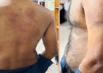 ലൈംഗികബന്ധത്തിൽ-ഏർപ്പെടാൻ-വിസമ്മതിച്ചു,-ബധിരനും-മൂകനുമായ-യുവാവിന്-ക്രൂര-മർദനം,-ലോഡ്ജിലെത്തിച്ചത്-സുഹൃത്തായ-യുവതി