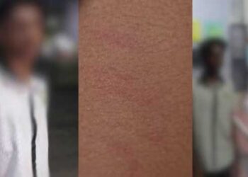 മുടി-വെട്ടിയതും-പുതിയ-ചെരിപ്പിട്ടതും-സീനിയർ-വിദ്യാർഥികൾക്ക്-പിടിച്ചില്ല!!-ഒമ്പതാംക്ലാസ്-വിദ്യാർഥികൾ-ചേർന്ന്-പരീക്ഷ-കഴിഞ്ഞിറങ്ങിയ-എട്ടാംകാസുകാരനെ-സ്കൂളിനു-പിന്നിലേക്ക്-പിടിച്ചുകൊണ്ടുപോയി-വളഞ്ഞിട്ട്-മർദിച്ചു,-സ്കൂൾ-ബസിൽ-കയറാൻ-പോലും-അനുവദിച്ചില്ല,-കുട്ടി-സ്വകാര്യ-ആശുപത്രിയിൽ-ചികിത്സയിൽ,