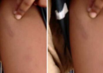 6-വയസുകാരന്റെ-മുഖത്തിന്റെ-ഒരു-വശത്ത്-തണുത്ത-പാൽക്കവർ-വെച്ച-ശേഷം-മറുഭാഗത്തെ-കവിളിൽ-ആഞ്ഞടിച്ചു,-കാലുകൾ-വളച്ചൊടിച്ച്-കഴുത്തോളം-വലിച്ചുനീട്ടി,-കഴുത്ത്-നിലത്തേക്ക്-അമർത്തിപ്പിടിച്ചു… -കുട്ടി-കരയുമ്പോൾ,-ശബ്ദം-പുറത്തുവരാതിരിക്കാൻ-വായിൽ-തുണി-തിരുകിയ-ശേഷം-വീണ്ടും-മർദ്ദനം,-ഉറങ്ങി-കിടക്കുമ്പോൾ-പോലും-കുട്ടിയെ-മർദിച്ചു…-രണ്ടാനച്ഛന്റെ-കയ്യിൽ-നിന്ന്-കുരുന്ന്-നേരിട്ടത്-സമാനതകളില്ലാത്ത-കൊടീയ-പീഡനം