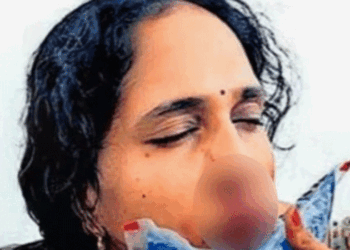 ക്ലാസിനിടെ-​ഗെയിം-കളിക്കരുതെന്ന്-പറഞ്ഞു;-വിദ്യാർത്ഥി-അധ്യാപികയെ-ആക്രമിച്ചു;-​ഗുരുതര-പരിക്ക്;-മൂക്കിന്റെ-എല്ല്-തകർന്നു