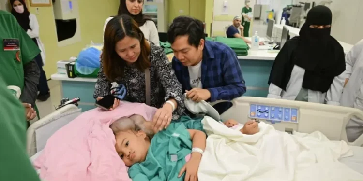 ലോകം-ഉറ്റുനോക്കുന്ന-അത്യപൂർവ്വ-ദൗത്യം;-സയാമീസ്-ഇരട്ടകളുടെ-ശസ്ത്രക്രിയ-റിയാദിൽ-തുടരുന്നു