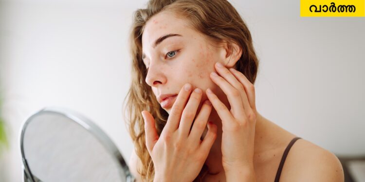 ac-dry-skin-problem:-ഓഫീസിൽ-ദിവസം-മുഴുവൻ-എസിയിൽ-ഇരിക്കുന്നത്-നിങ്ങളുടെ-സ്കിൻ-വരണ്ടതാക്കുന്നുണ്ടോ?-ചർമ്മത്തിലെ-ജലാംശം-നിലനിർത്താം-ഈ-5-വഴികളിലൂടെ!