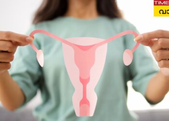 pcos-renamed-as-pmos:-സ്ത്രീകളെ-ബാധിക്കുന്ന-ഹോർമോൺ-രോഗമായ-pcos-ഇനി-pmos:-പുതിയ-പേരിന്റെ-അർത്ഥമെന്താണ്?-എന്തുകൊണ്ട്-പ്രാധാന്യമർഹിക്കുന്നു?